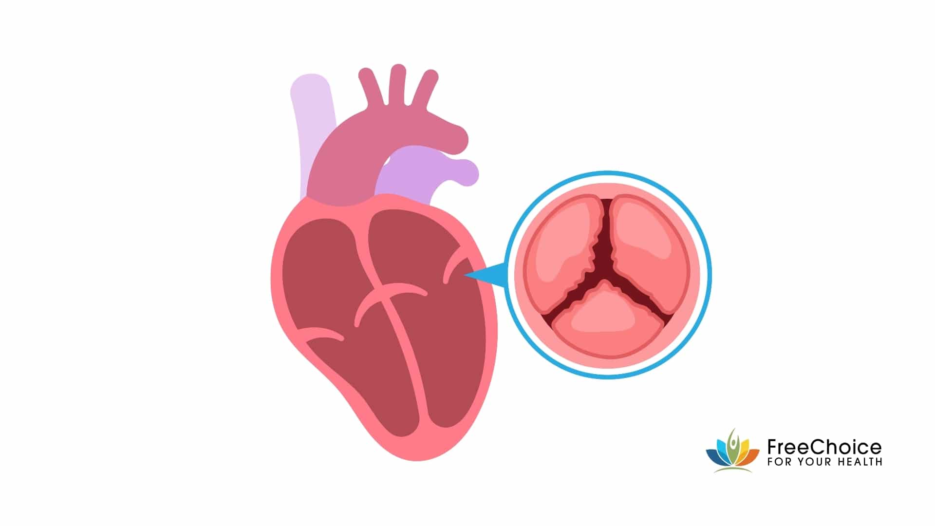 heart klep